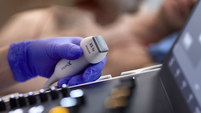 Ультразвуковая диагностика