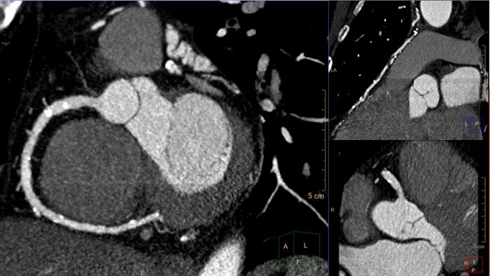 CT cardiac viewer