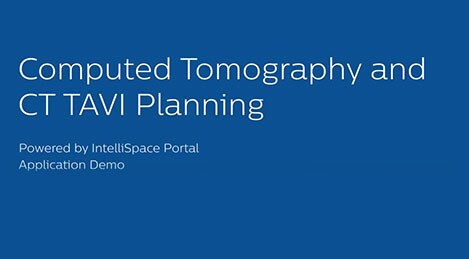 Клиническое приложение CT TAVI