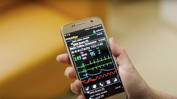 Использование мобильных устройств для управления сигналами тревоги с Philips CareEvent, видеоролик