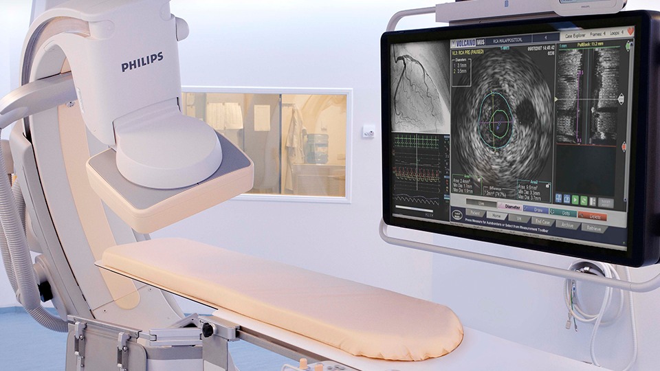 Темнов узи. IVUS внутрисосудистое УЗИ. ВСУЗИ Philips. УЗИ аппараты для внутрисосудистых исследований. ВСУЗИ Volcano.