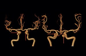 banner catalog image
