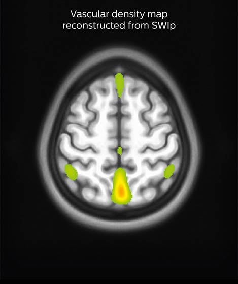 Sherbrooke_SWIp image