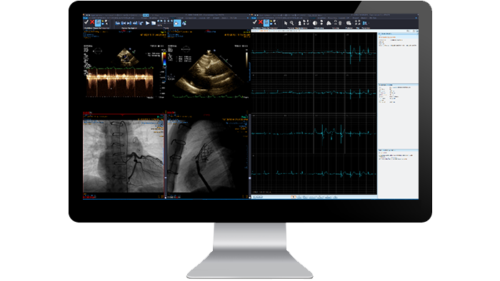 Экран интерфейса модуля кардиологии