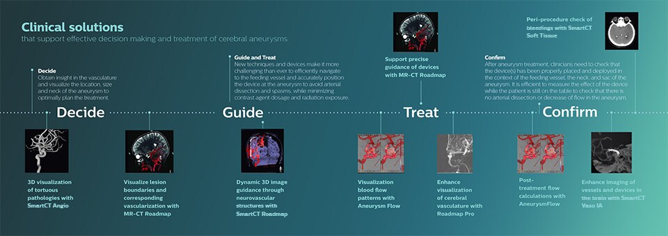 Клинические решения для лечения аневризм головного мозга