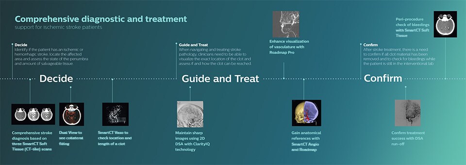 Клинические решения для лечения ишемического инсульта