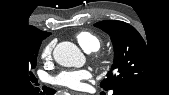Функция Precise Cardiac