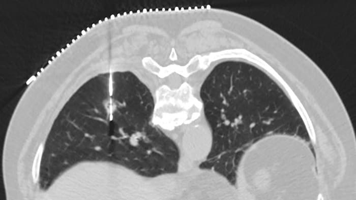 Функция Precise Intervention