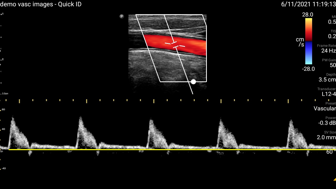 Third Lung thumbnail