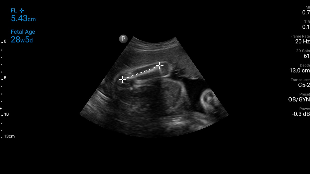 Cardiac chart thumbnail