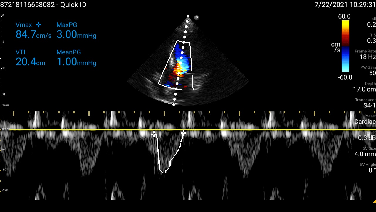 Soft tissue thumbnail