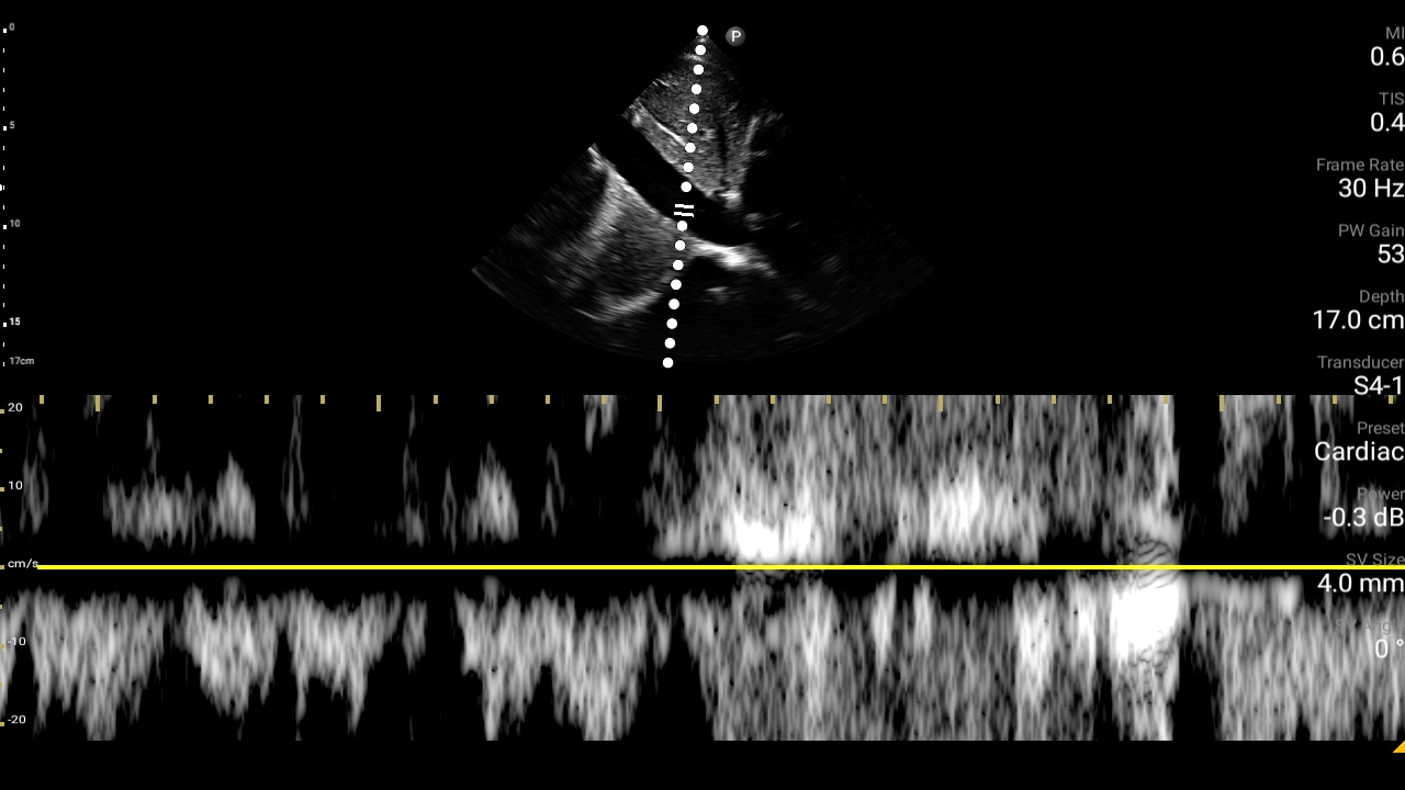 Kidney liver thumbnail