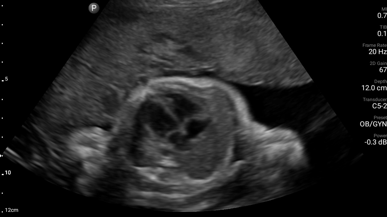 Cardiac chart thumbnail second