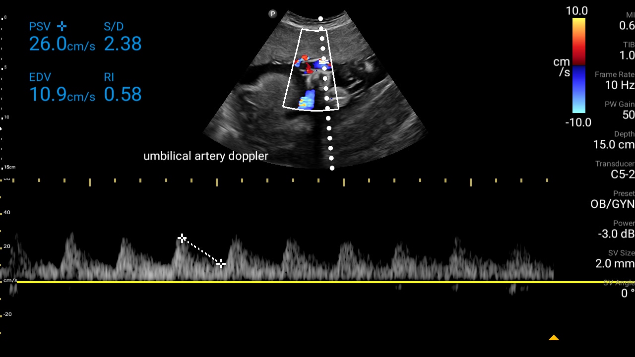 Cardiac chart thumbnail third