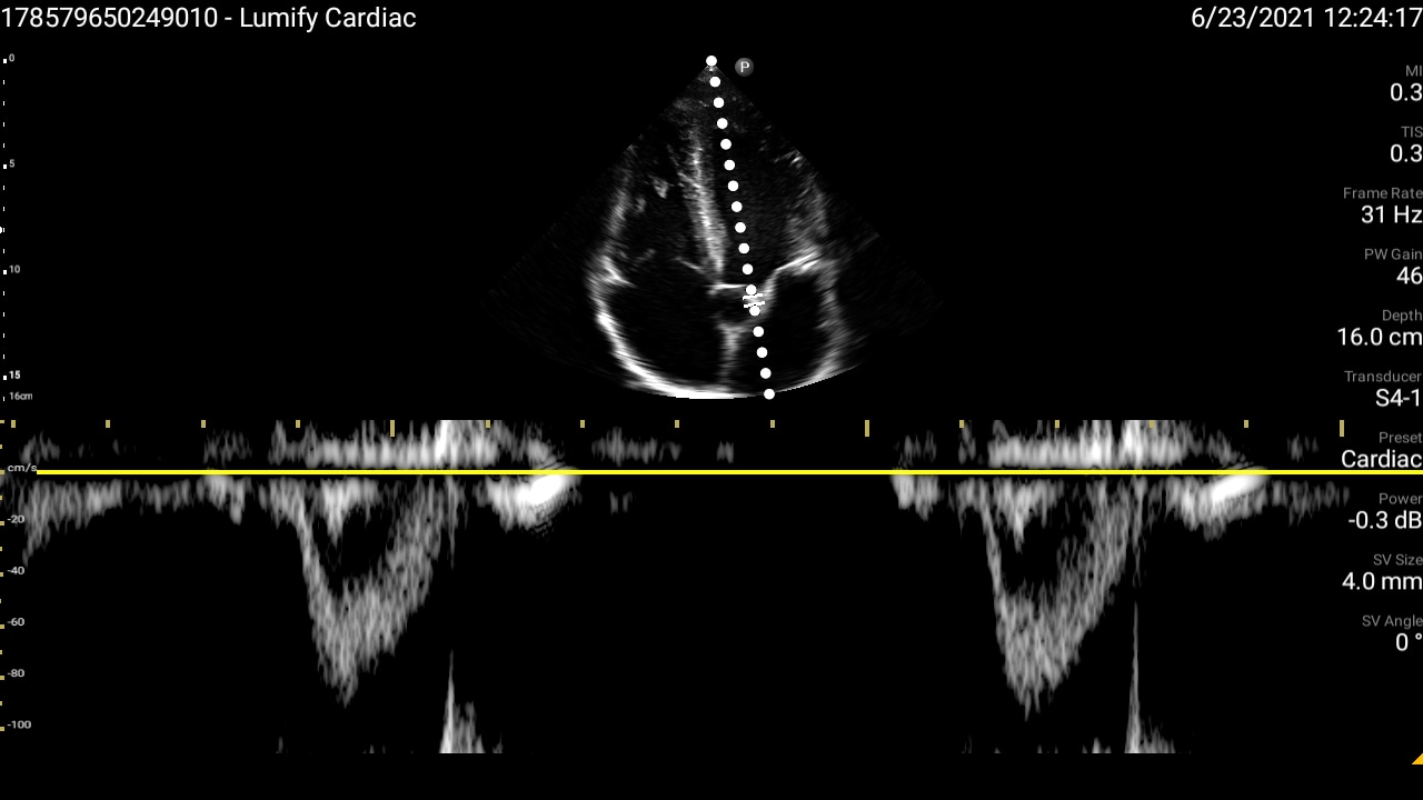 Vascular thumbnail