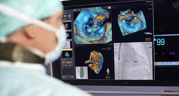 Технологии навигации в режиме реального времени при лечении структурных заболеваний сердца