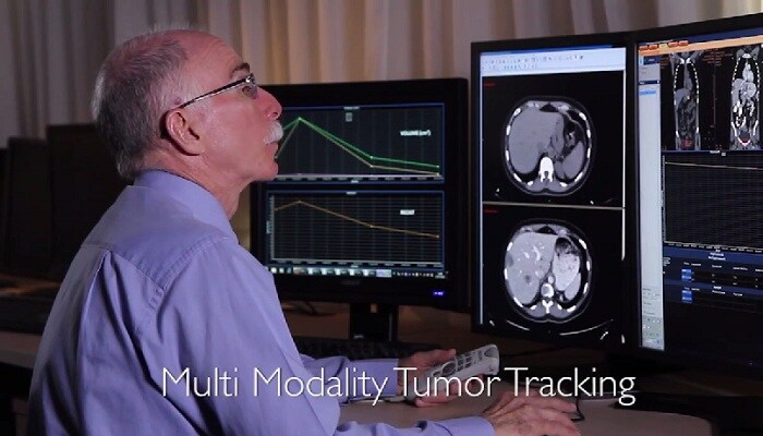 Оценка результатов терапии путем количественного анализа: приложение для мультимодального отслеживания опухолей на системе IntelliSpace Portal