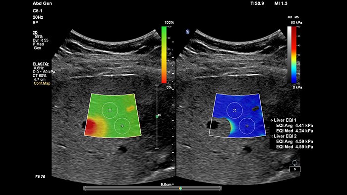 epiq 7 ultrasound machine