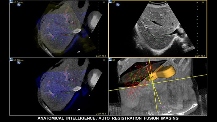 epiq 7 ultrasound machine