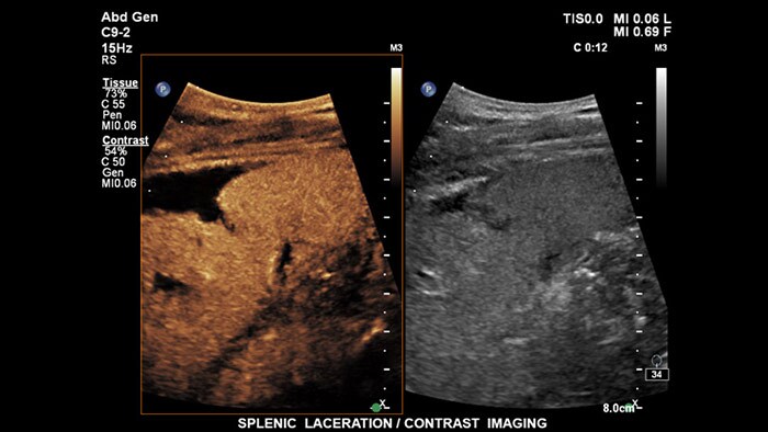 epiq 7 ultrasound machine