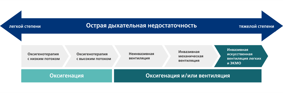 Инвазивная вентиляция легких и ЭКМО, изображение