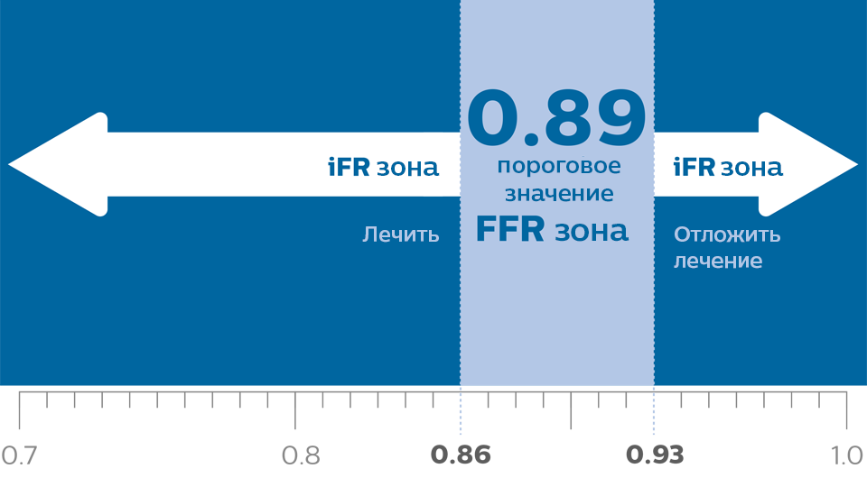 Методика комбинированного измерения iFR