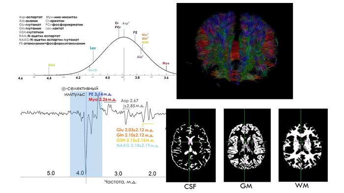 Исследования последствий черепно-мозговых травм у детей