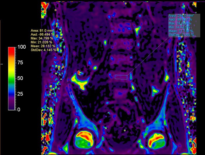 MRI (download .jpg)