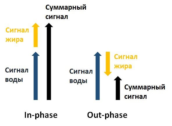 Интенсивность принимаемого сигнала в синфазном и противофазном изображении