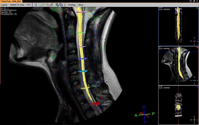 Visualization_pathways