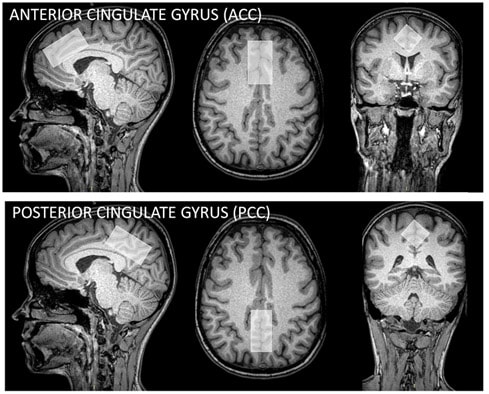 ISMRM