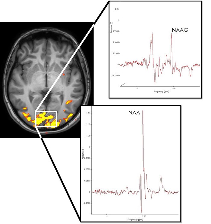 fMRI