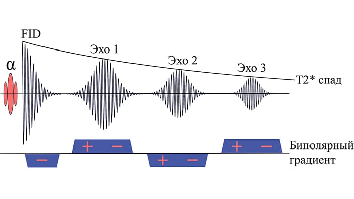 Импульсная последовательность мультиградиентного эха.