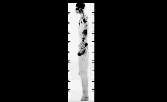full body scan image