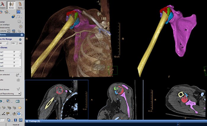 CT Acute Multifunctional Review (AMFR)