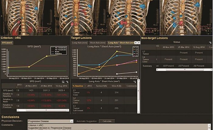 Multi Modality Tumor Tracking (MMTT)