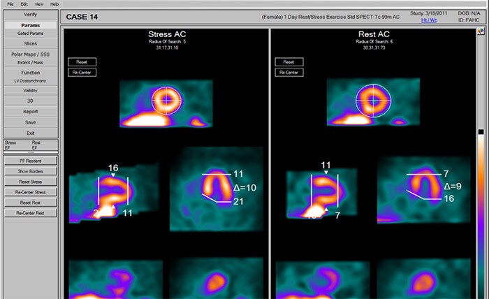 NM Emory Cardiac Toolbox (ECTb)