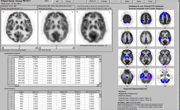 NM NeuroQ