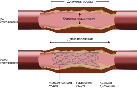 Интерпретация, изображение