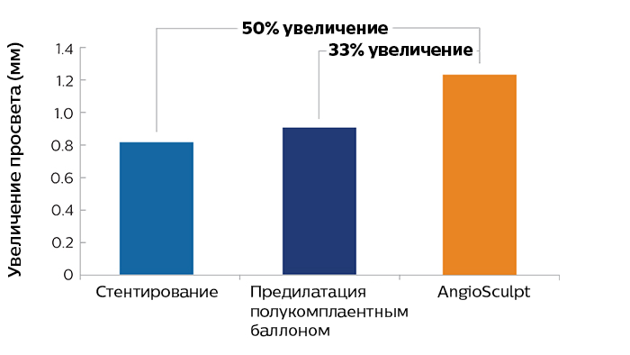 больший просвет при ISR