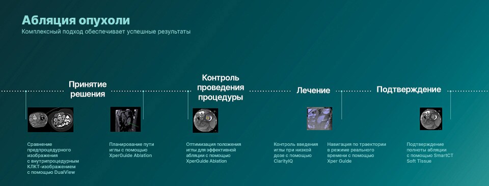 Инфографика абляции опухоли