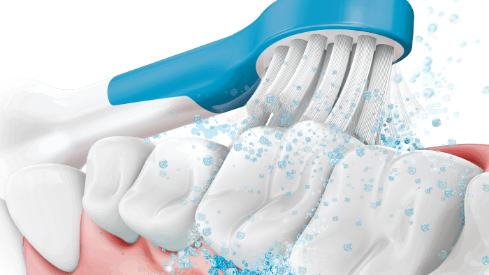 Удаляет налет