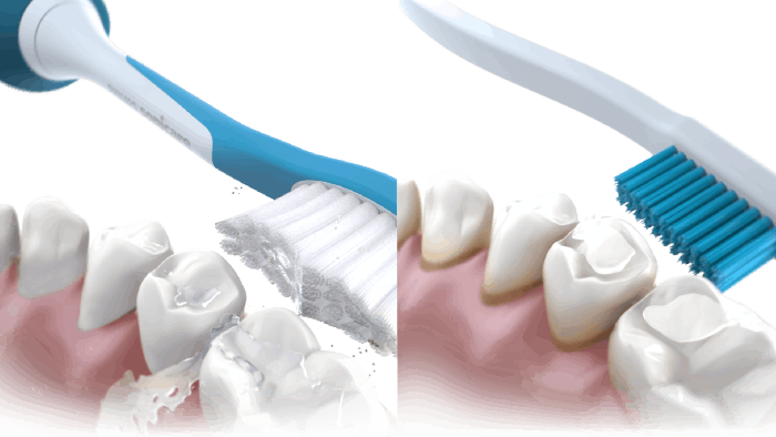 Удаляет налет