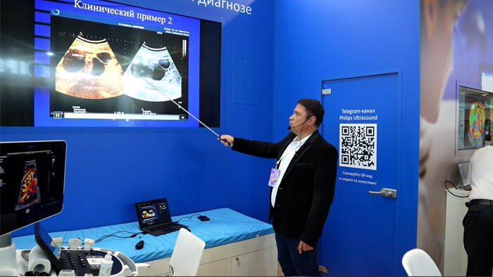 Мультипараметрическое УЗИ полостных образований почек с применением контрастного препарата