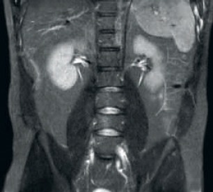 Принимающая система dStream