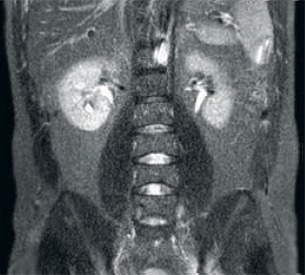 другое принимающее устройство