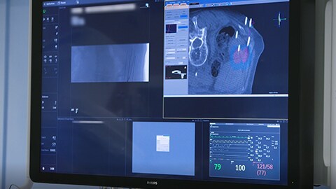 Philips Azurion 7&nbsp;М20 с потолочным креплением, отзывы клиентов из больницы St. Antonius, г. Ньювегейн, Нидерланды