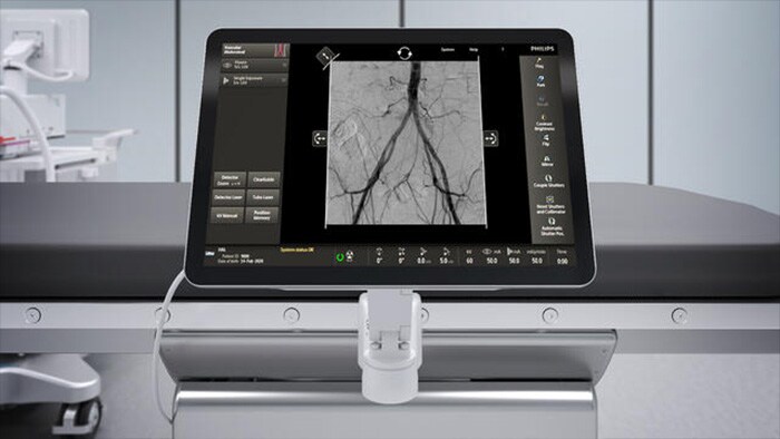 TSM изображение