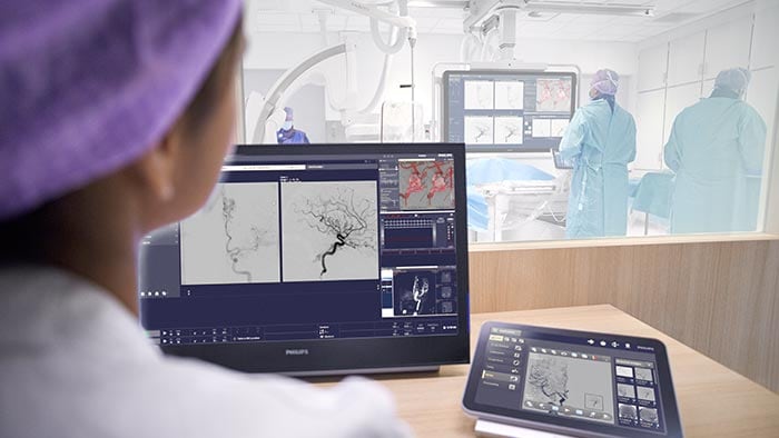 Технологии для нейроинтервенций