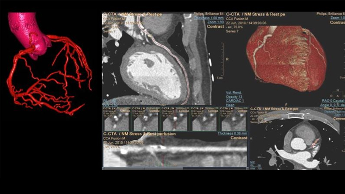 IntelliSpace Portal на основе ИИ c&nbsp;3D-моделями